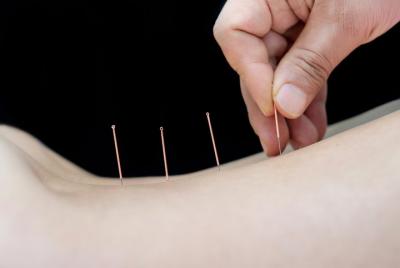 Doctor Liang's acupuncture